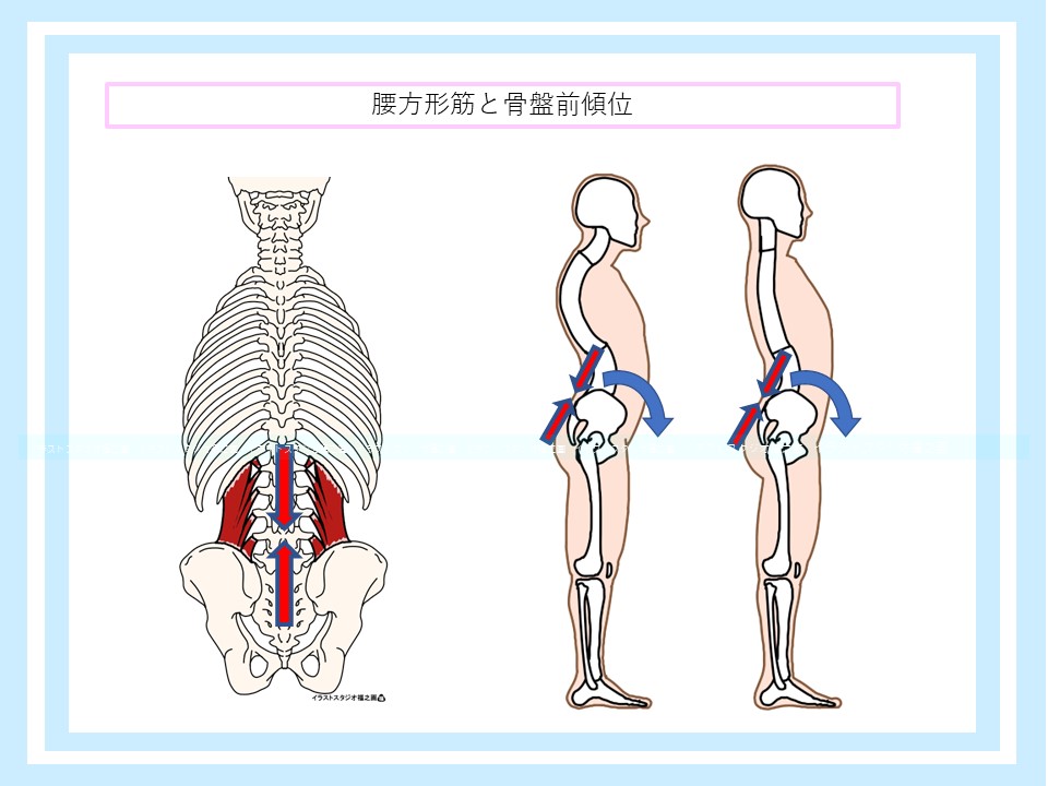 腰方形筋と姿勢