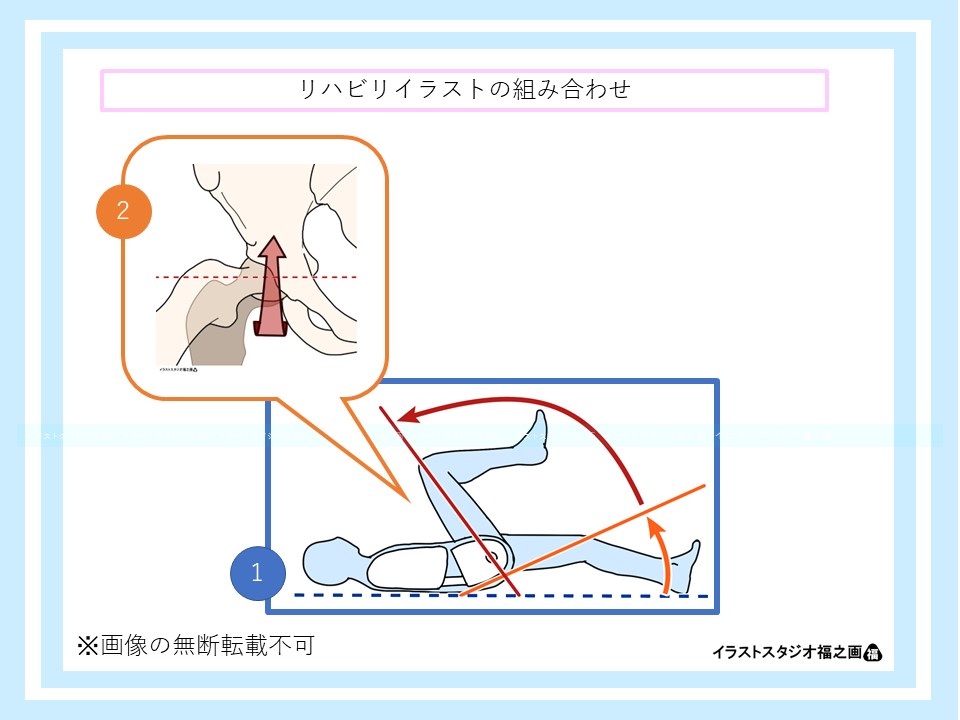 股関節屈曲90°で頸部と臼蓋が接する