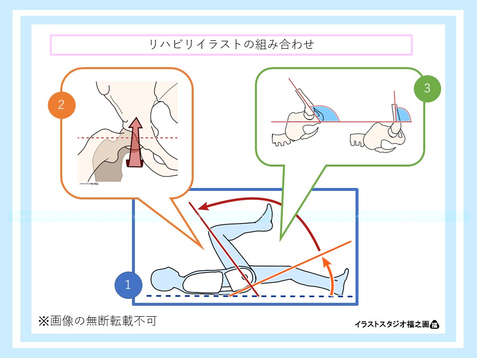 股関節屈曲機能