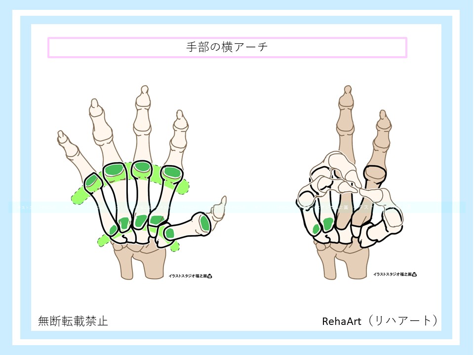 イラストで分かる手部アーチ構造：横アーチ