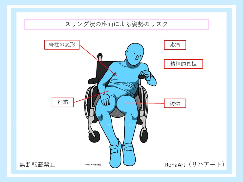 スリング状の座面による車いす姿勢のリスクとして拘縮・褥瘡・変形・精神的負担・疼痛がある