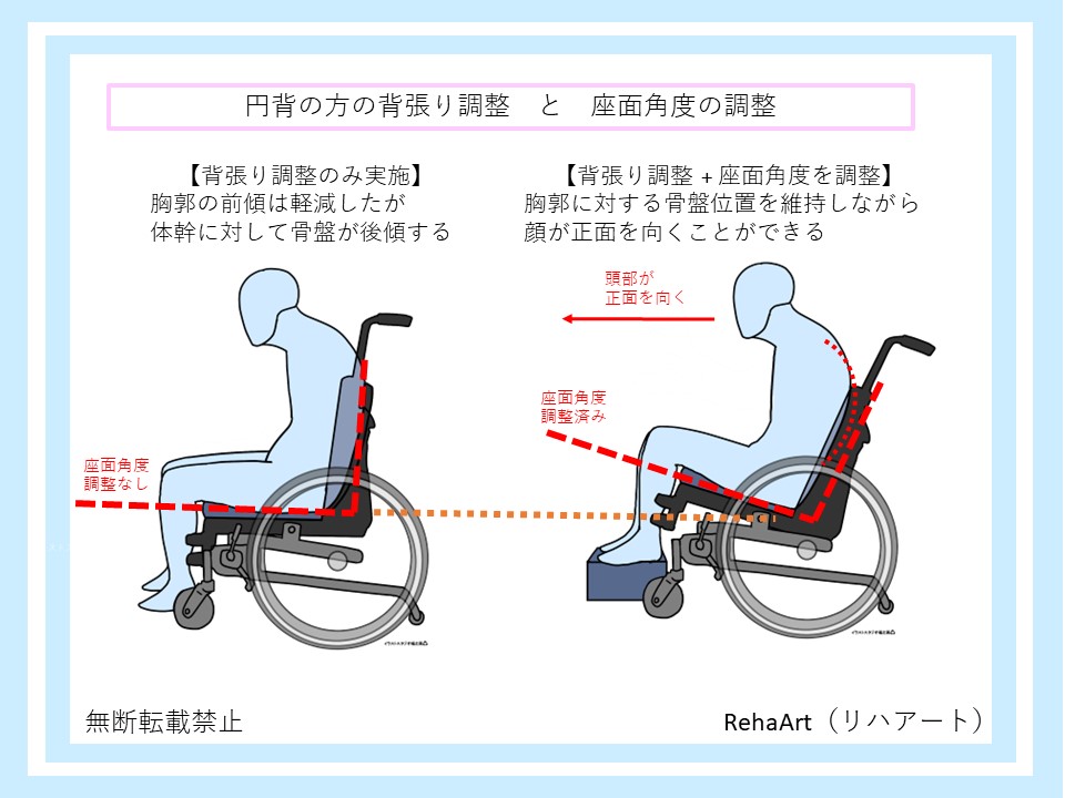 円背の方は車いすの背張り調整と座面角度の調整で姿勢が安定する