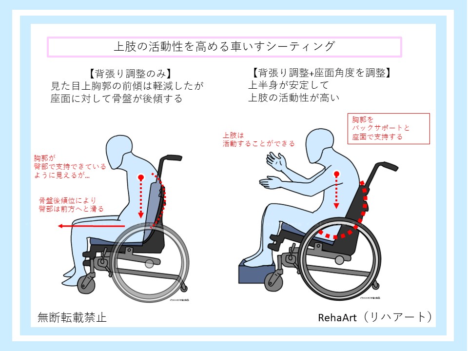 上肢の活動性を高める車いすシーティング