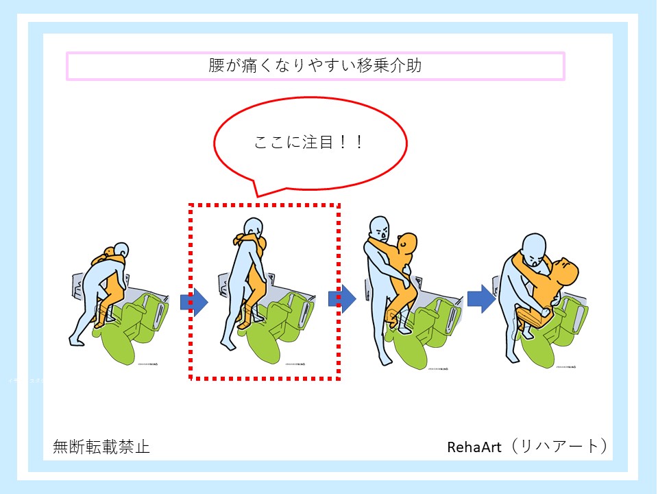 腰が痛くなりやすい移乗介助