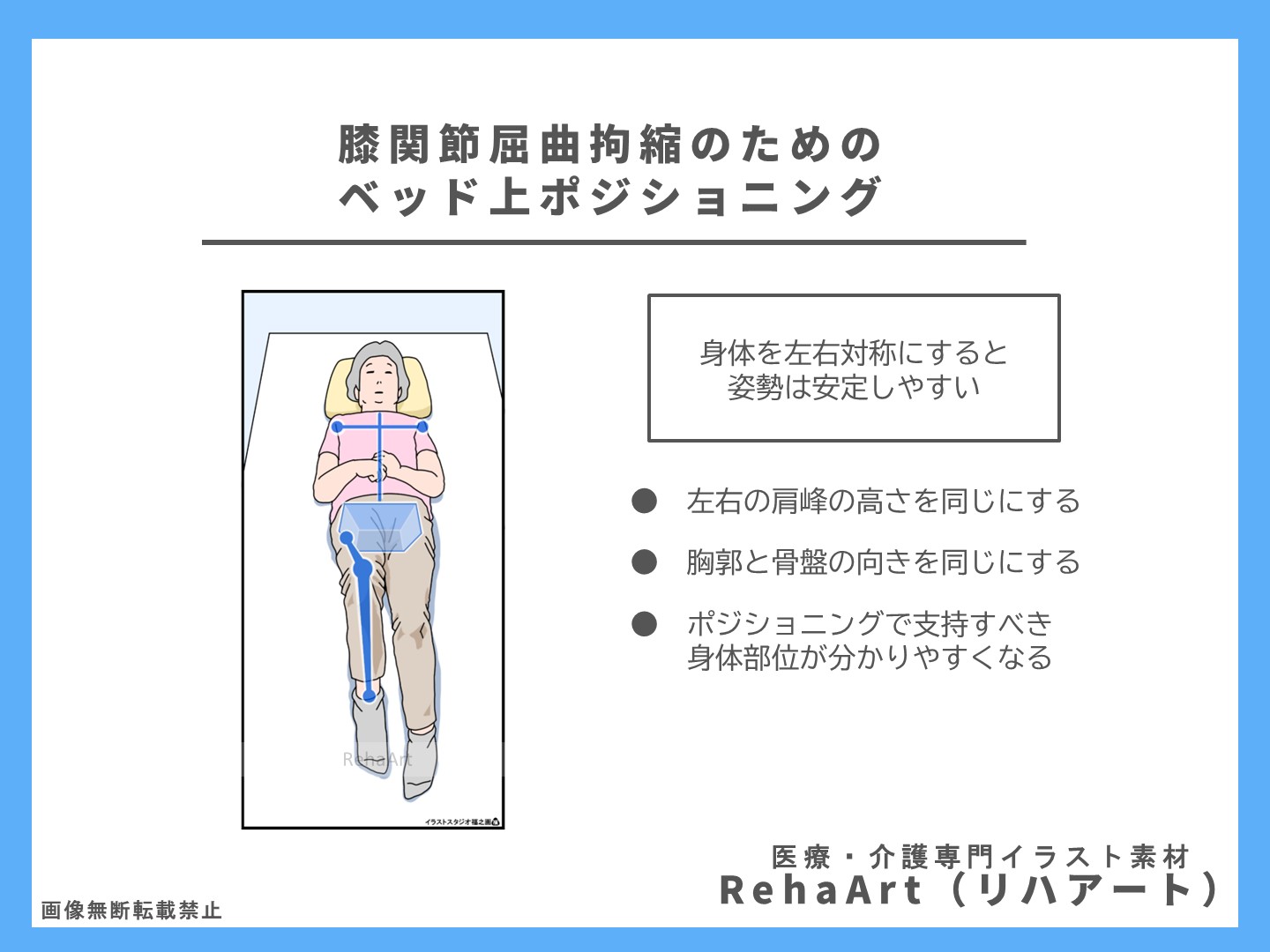 身体の向きを左右対称にすることでポジショニングが必要な身体部位がわかる