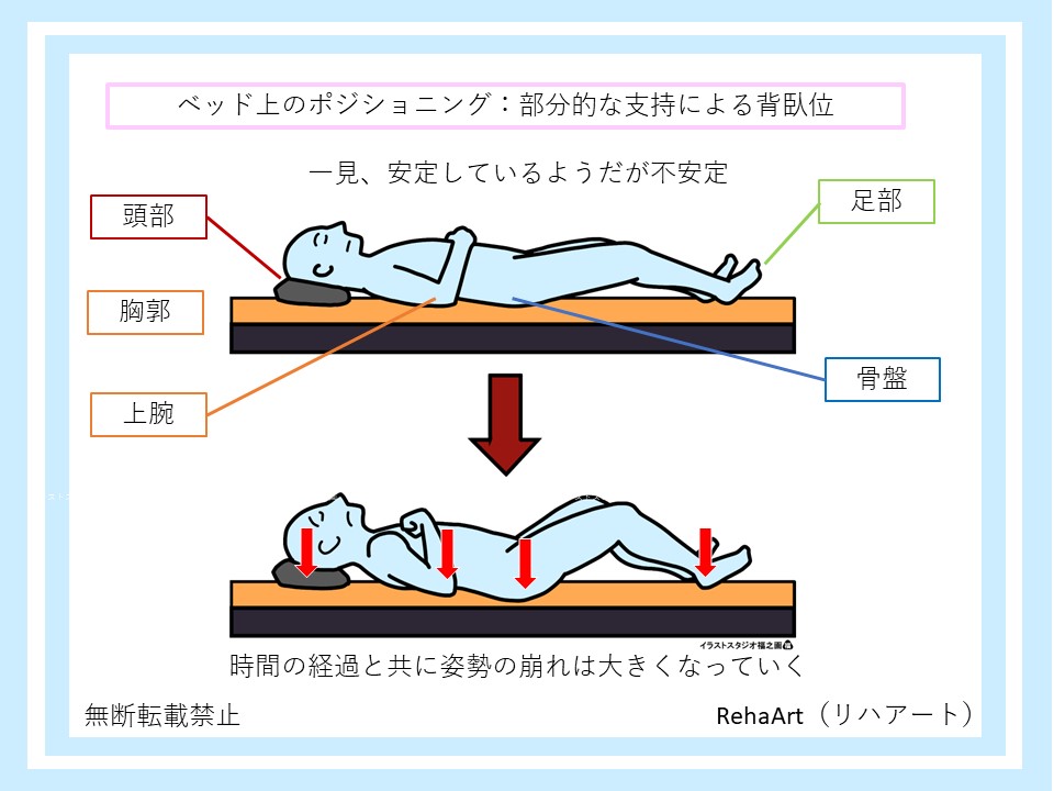 ベッド上ポジショニングで部分的な支持に支持により不安定な姿勢になっている図