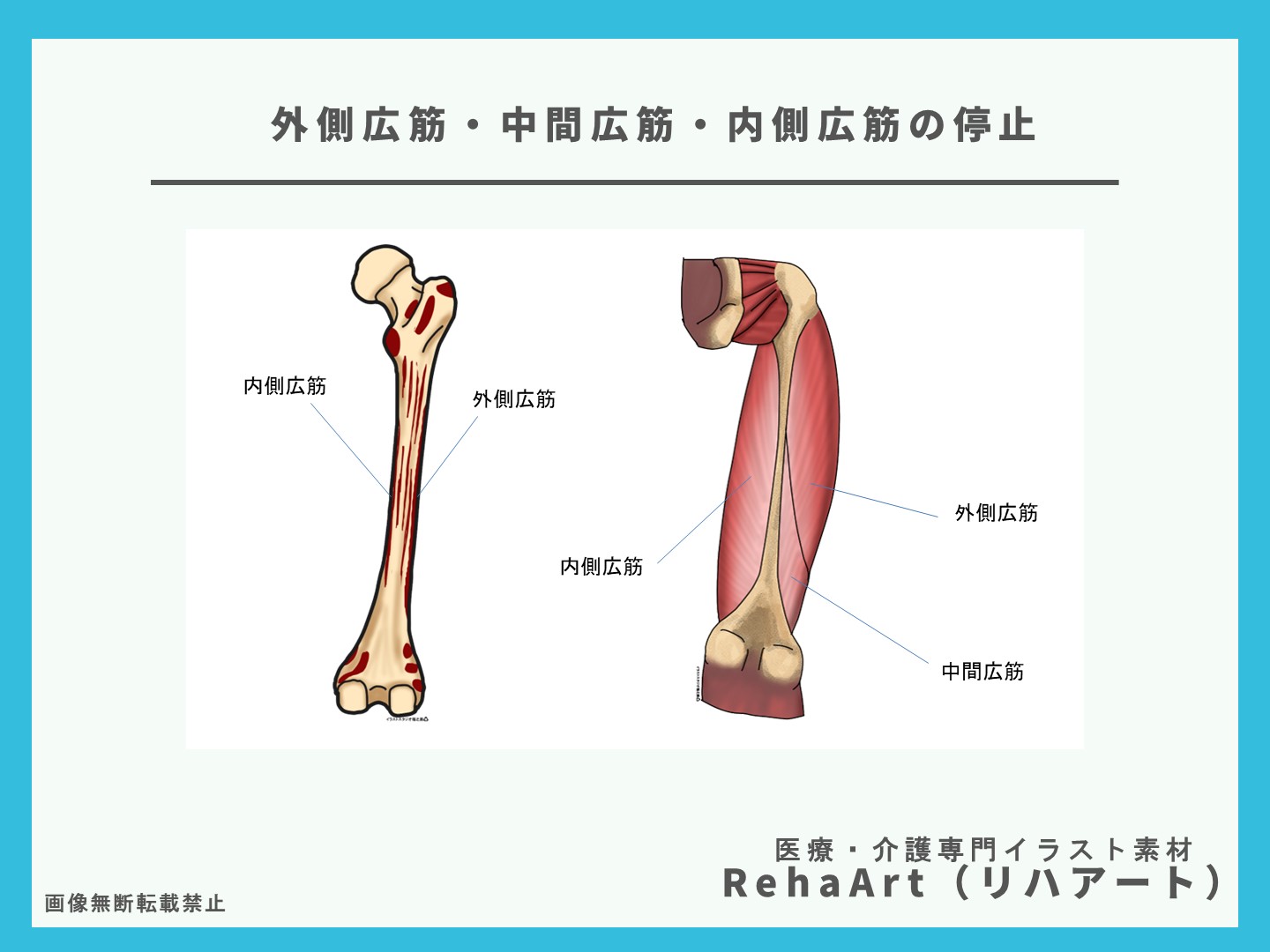 イラストで分かる外側広筋・中間広筋・内側広筋の停止