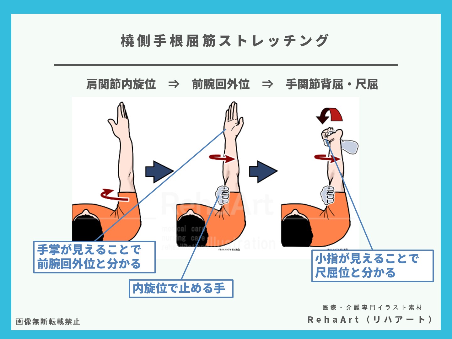 橈側手根屈筋ストレッチングの方法