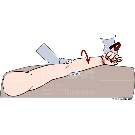 イラストで分かる総指伸筋ストレッチング２