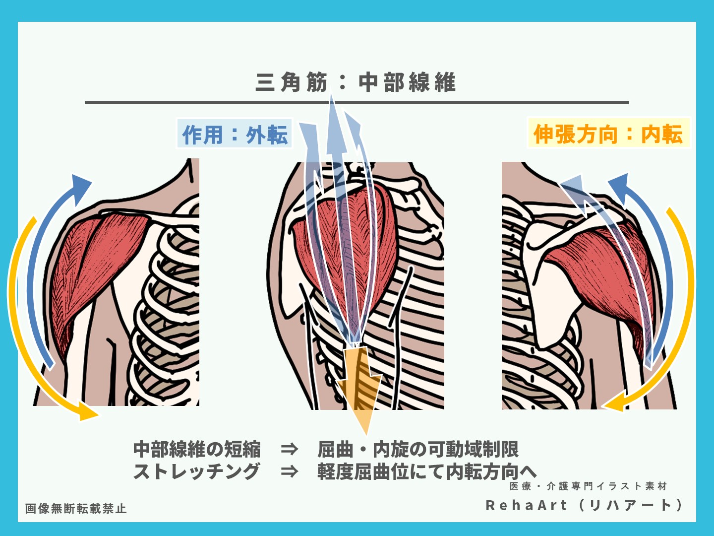 三角筋、中部線維、ストレッチング、短縮、評価