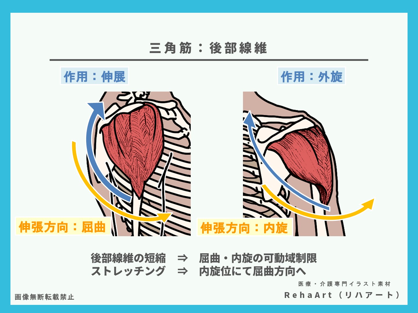 三角筋、後部線維、ストレッチング、短縮、評価