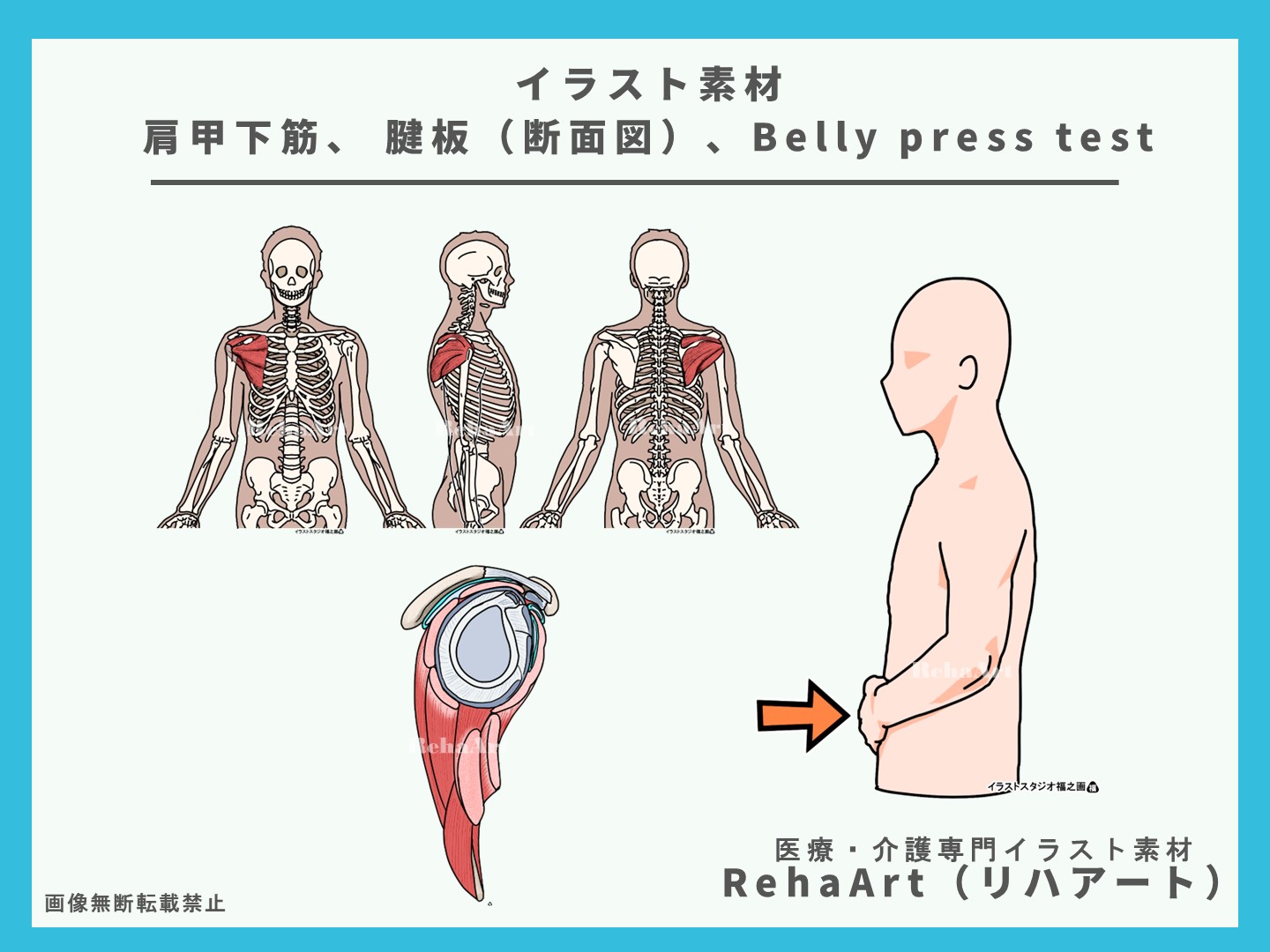肩関節の整形外科テスト：Belly press test（ベリープレステスト）イラスト、画像、検査、評価、疼痛、原因、肩甲下筋3