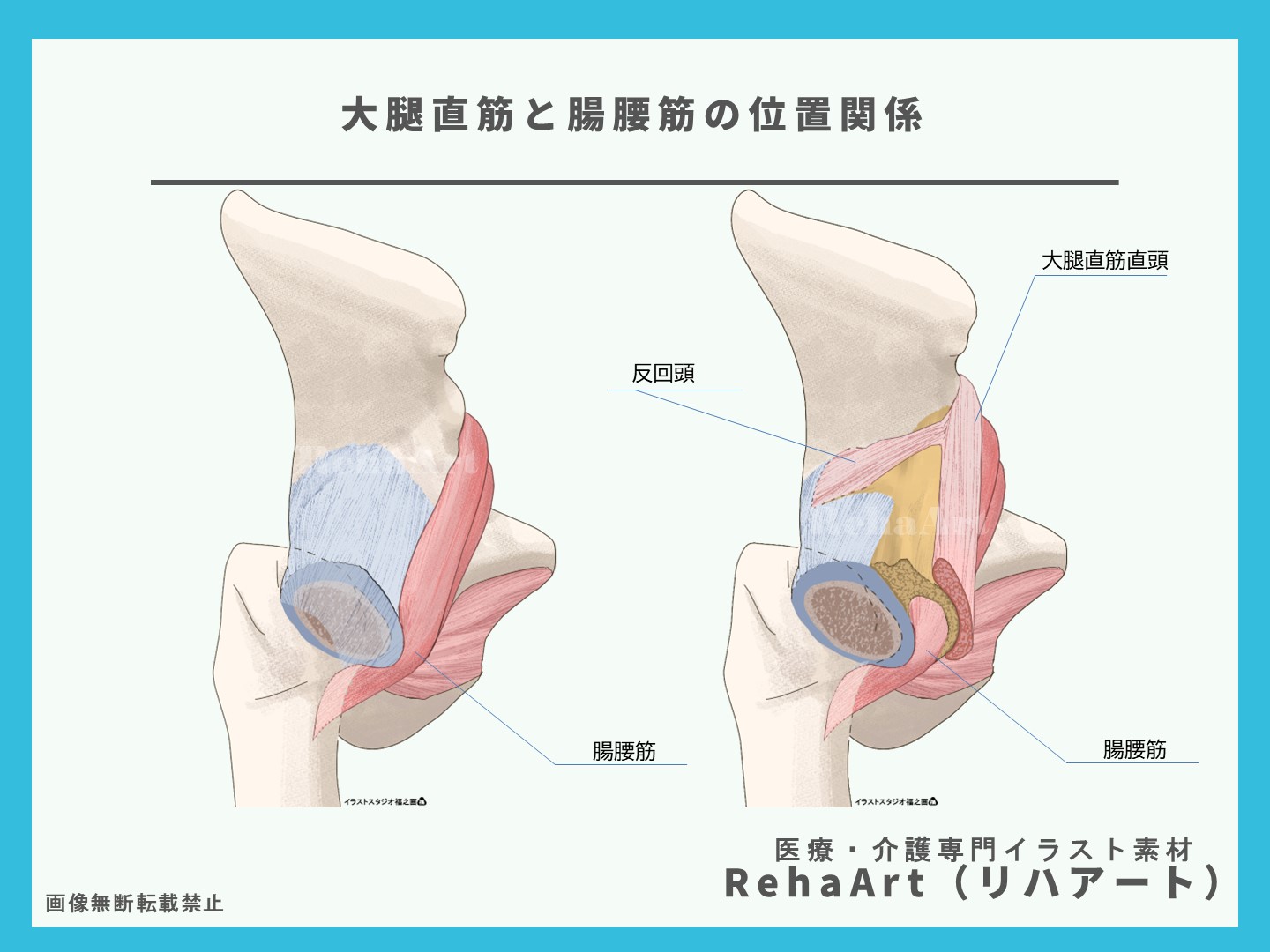 腸腰筋・大腿直筋・直頭・反回頭・股関節・関節包・断面図・イラスト・制作・依頼・セミナー・リハビリ2（修正版）