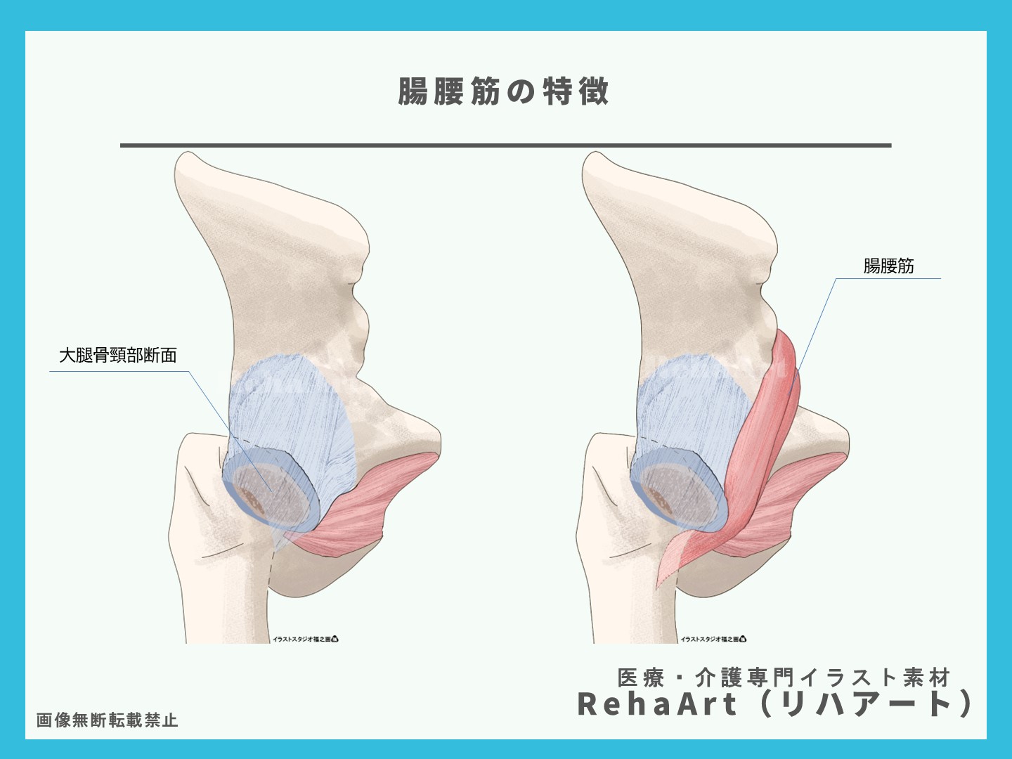腸腰筋・股関節・関節包・断面図・イラスト・制作・依頼・セミナー・リハビリ1