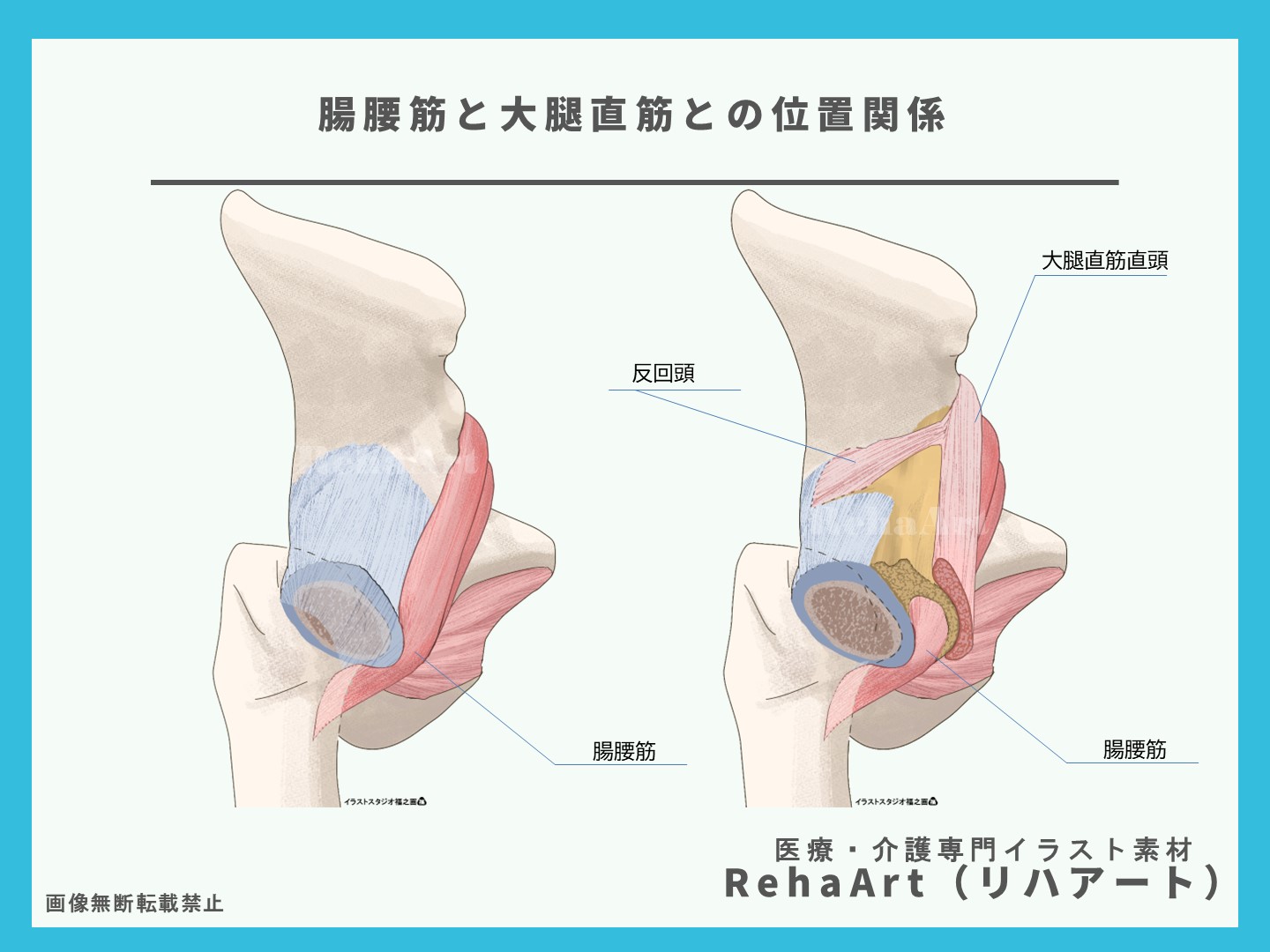 腸腰筋・股関節・関節包・断面図・イラスト・制作・依頼・セミナー・リハビリ2