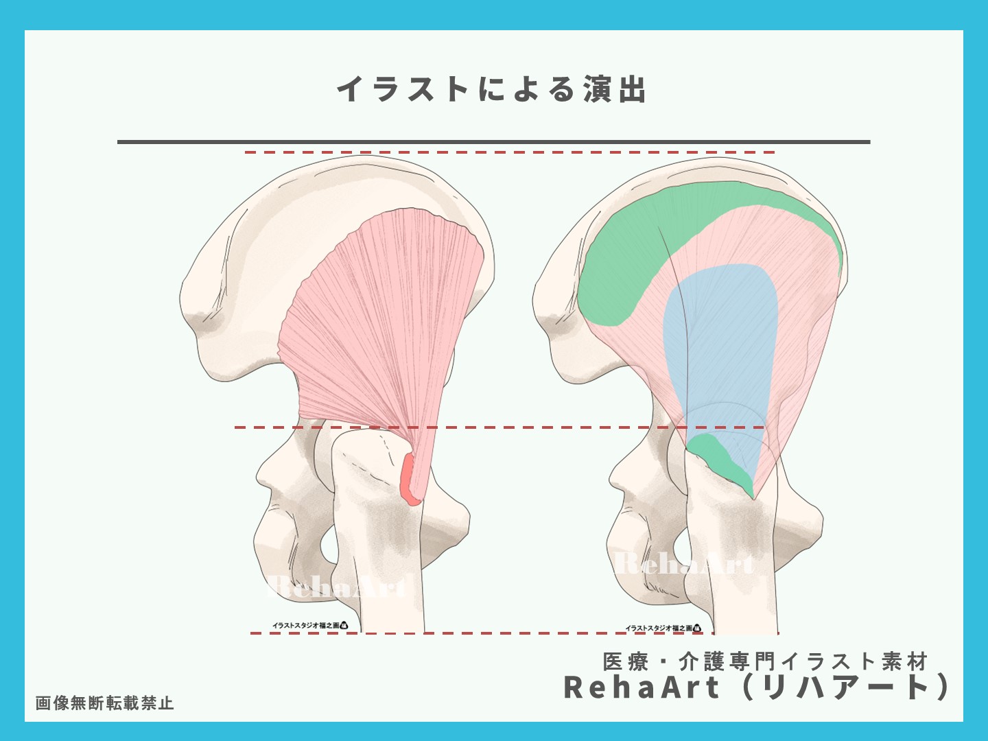 中殿筋と小殿筋の解剖図による解説、起始停止、作用、筋線維、イラスト、股関節4