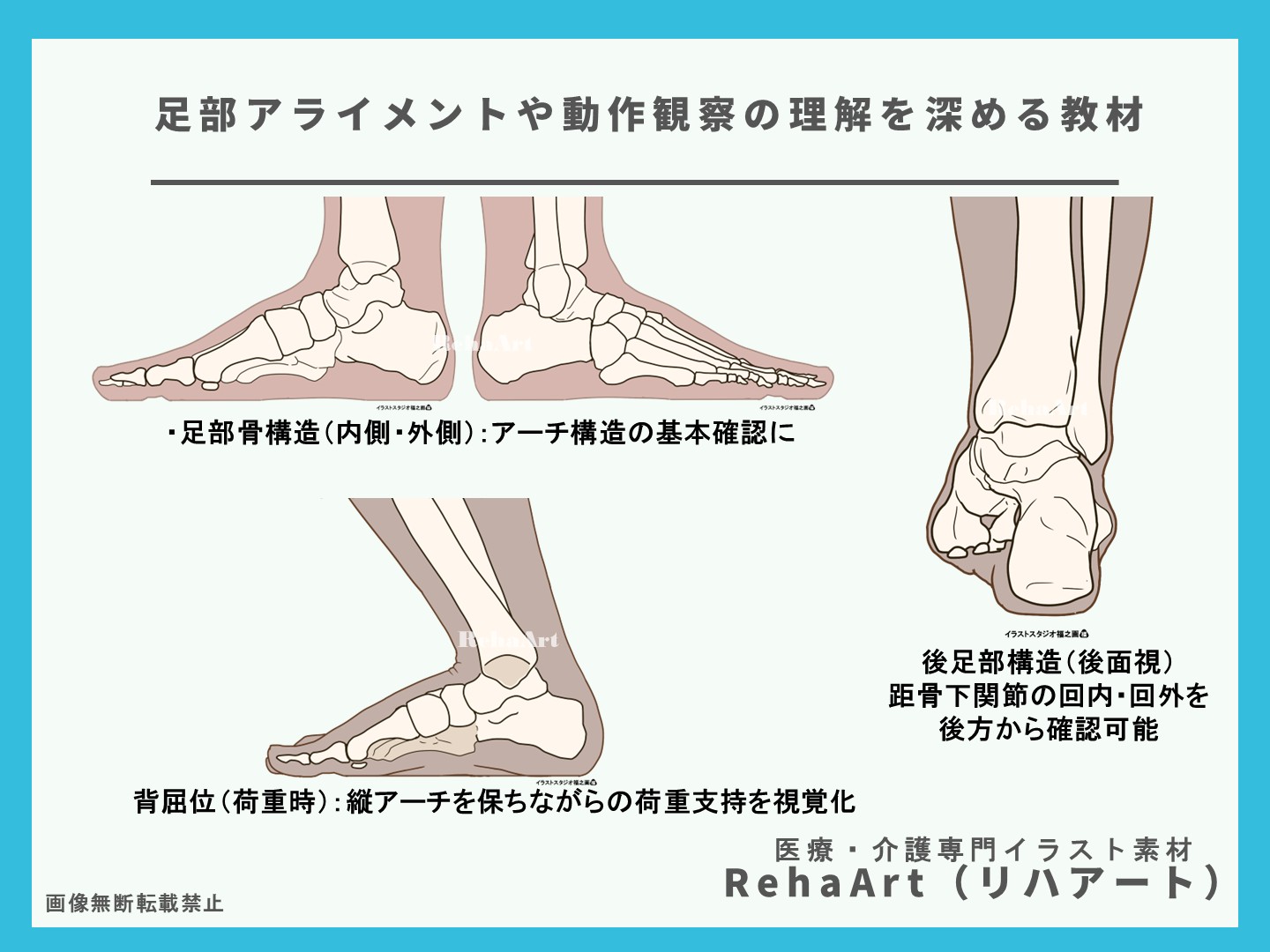 内がえし・外がえし・荷重・下腿・傾斜・アライメント・関節3