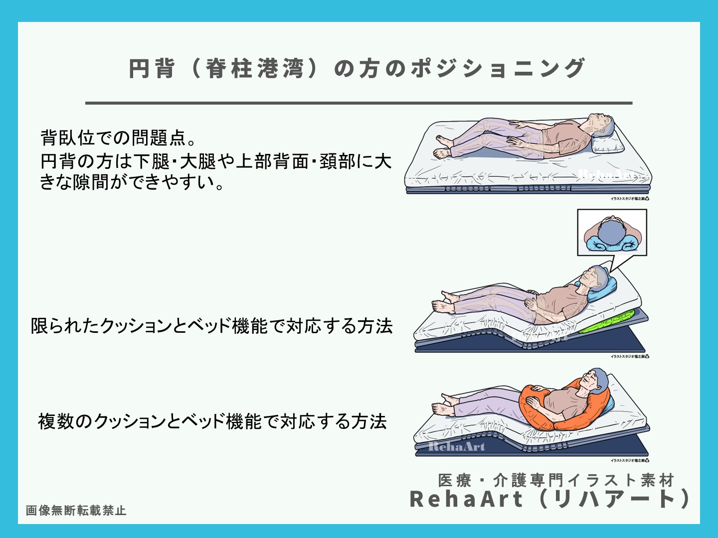 ベッド、ポジショニング、円背、高齢者、リハビリ、介護、クッション、やり方、簡単、褥瘡予防、イラスト、図、画像2