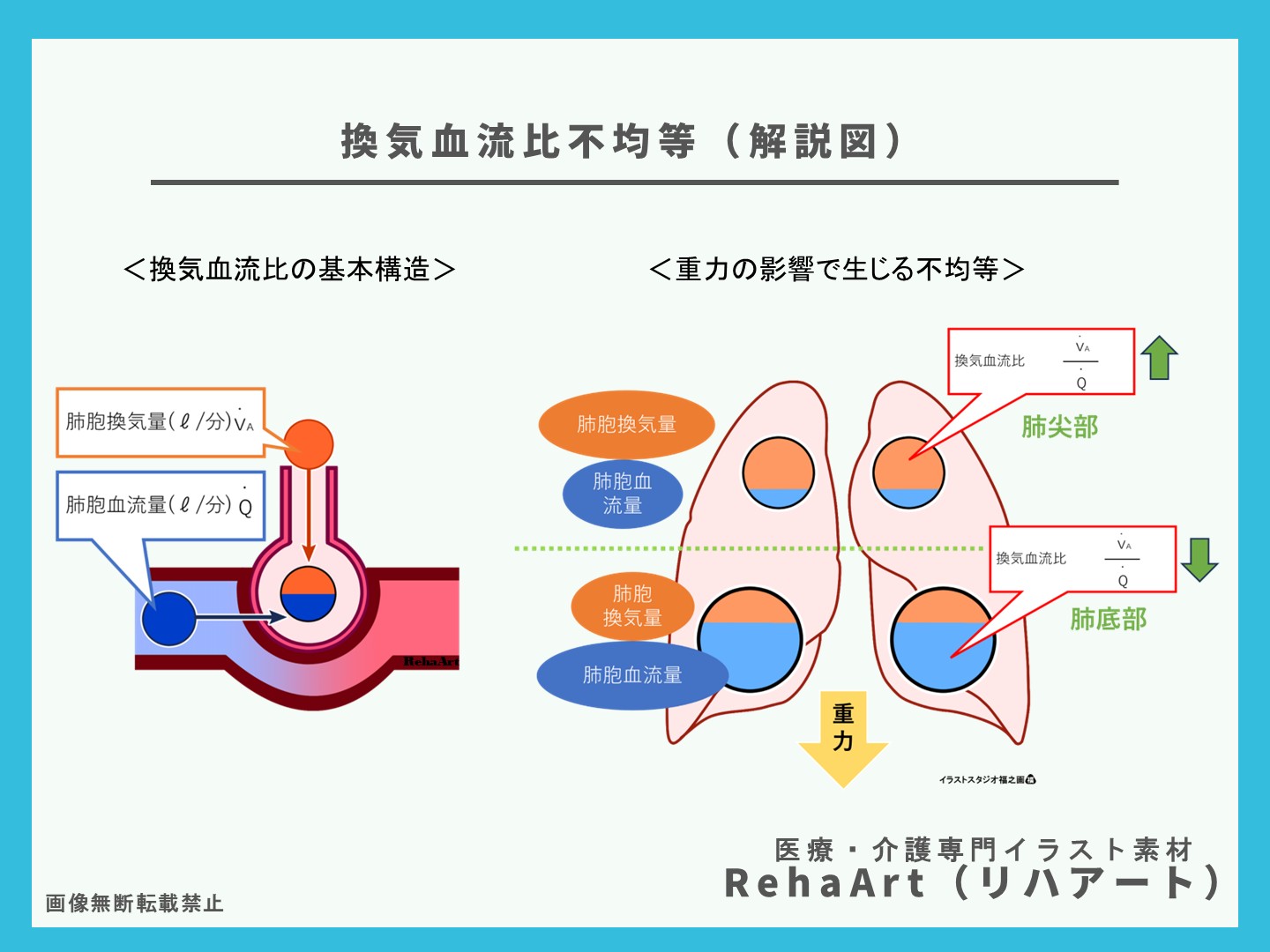 換気血流比（VQ比）を理解する ― 正常肺にもある「不均等」の仕組み3